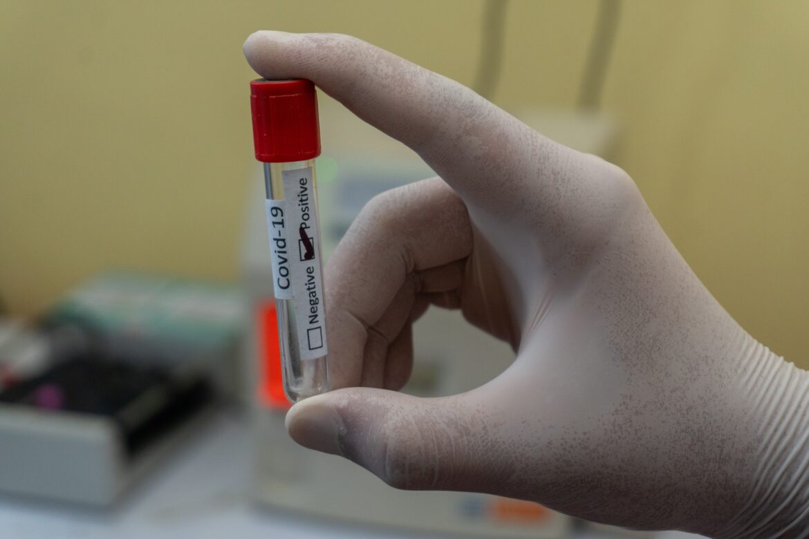 Sanidad detecta brotes coronavirus Sanidad detecta brotes coronavirus